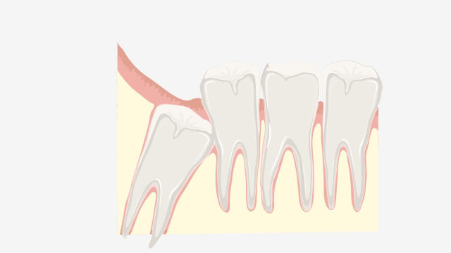 مشکل در رشد دندان